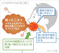 ある フロス 臭い ところが デンタルフロスが臭い原因は！？口臭との関係/改善方法