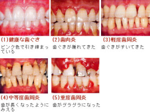 FE1AA541-19A3-4A5F-9FD2-62FAF5D81A26