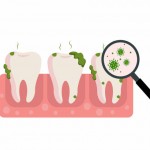 Dirty and smelly teeth with Bad breath Magnifying glass examine teeth with bacteria concept of oral hygiene.